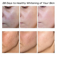 Fupah crema pigmentación y melasma, mejora la apariencia de manchas.