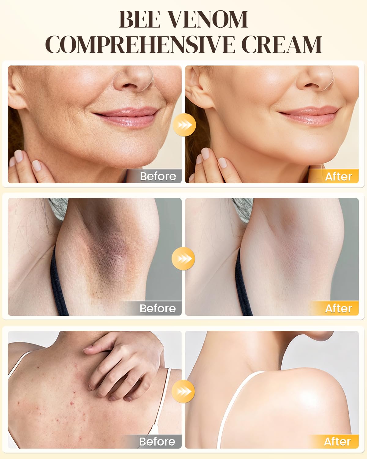 GAJUANR Crema veneno de abeja, uso en brazos y piernas para suavizar textura.