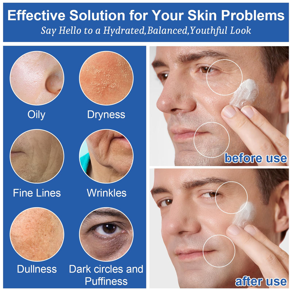Geb-Eaty exfoliante facial suave, elimina células muertas y deja la piel fresca
