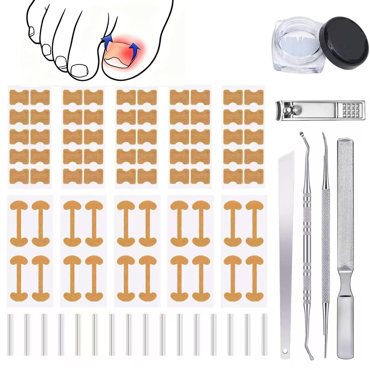 Gemsanva kit corrector uña encarnada listo para uso doméstico y alivio suave.
