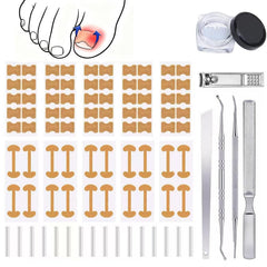 Gemsanva kit corrector uña encarnada listo para uso doméstico y alivio suave.