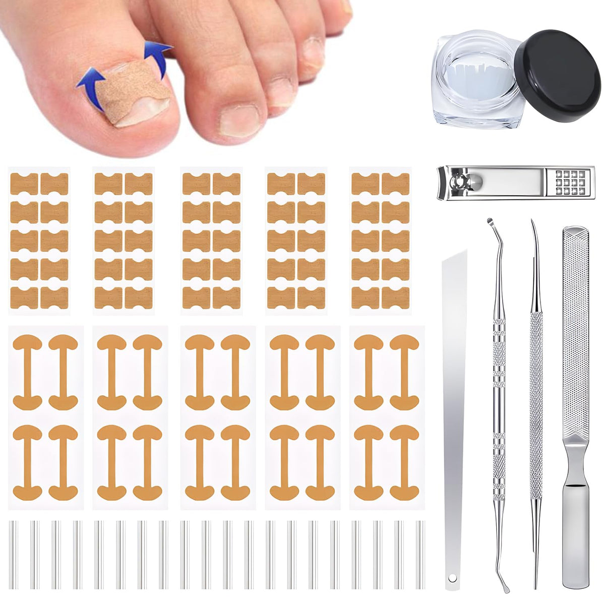 Generic corrector de uñas encarnadas: kit completo para cuidado en casa