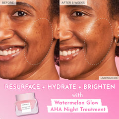 Glow Recipe Sandía Exfoliación Suave: renovación suave de la textura de la piel.