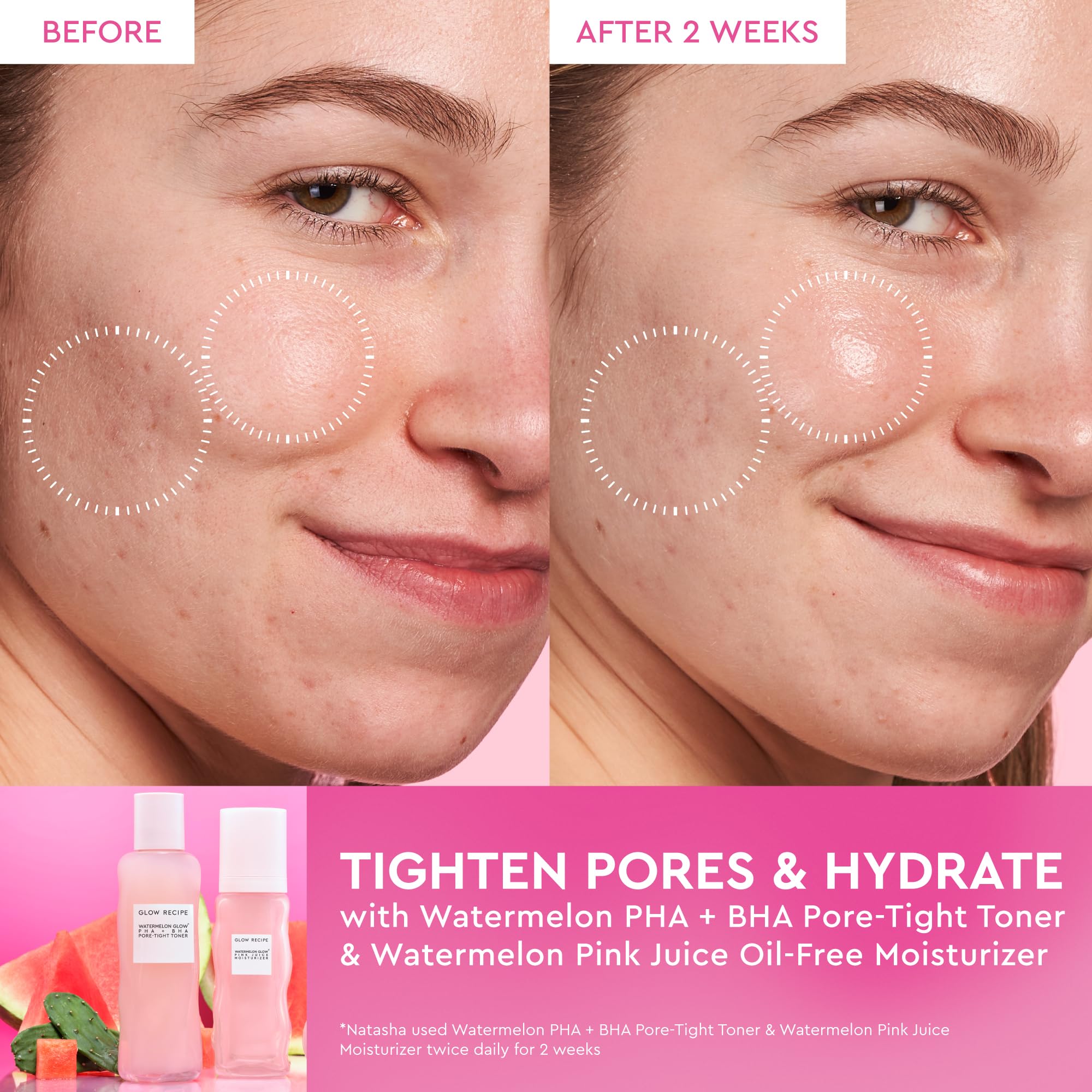 Glow Recipe Toner: aplicación con manos aporta hidratación profunda y tono uniforme.