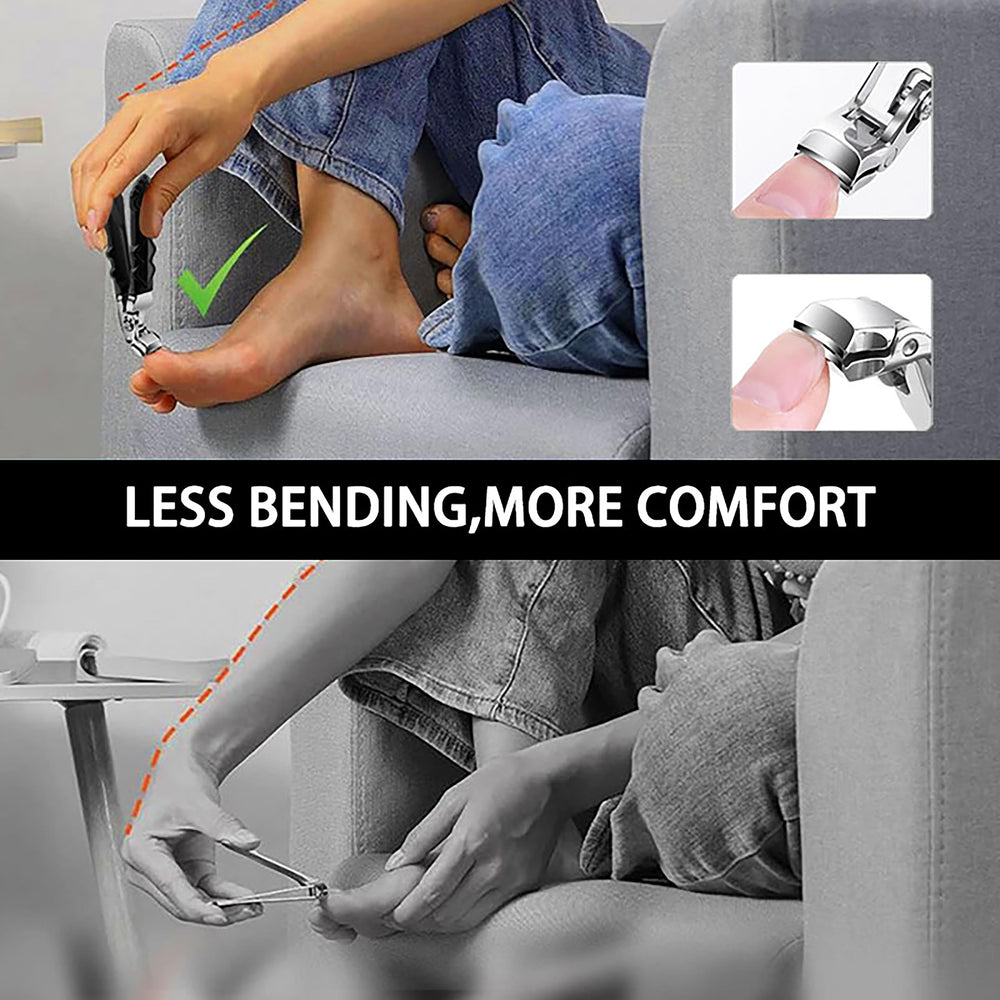 Goredny Orthoclip acero inoxidable de alta calidad y durabilidad.