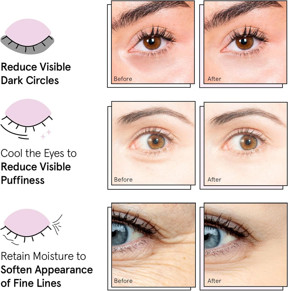 Grace & Stella parches ojos 72 pares, solución de cuidado diario para miradas cansadas