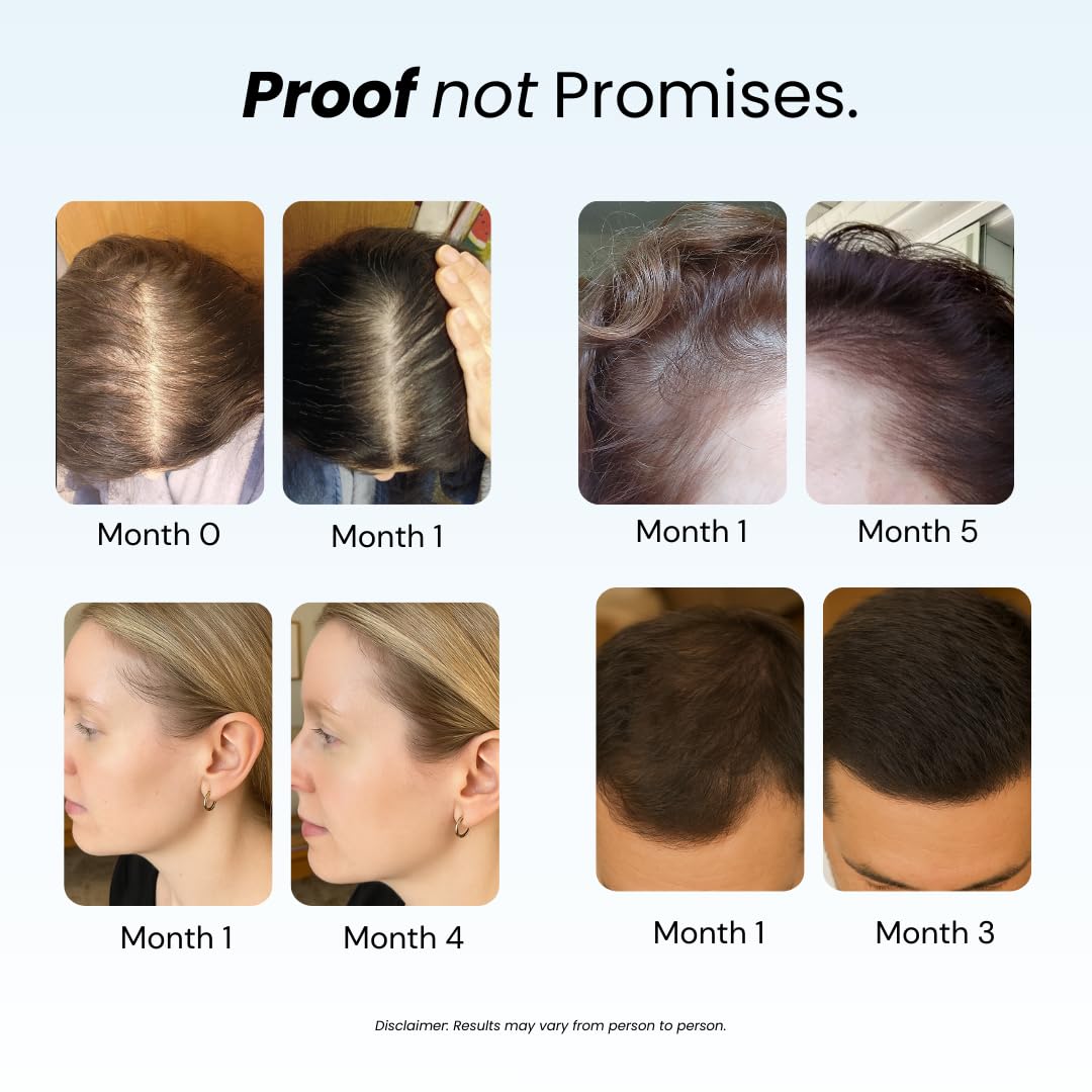 Growplex Replenish: etiqueta y aceites botánicos muestran nutrición para cabello más saludable.