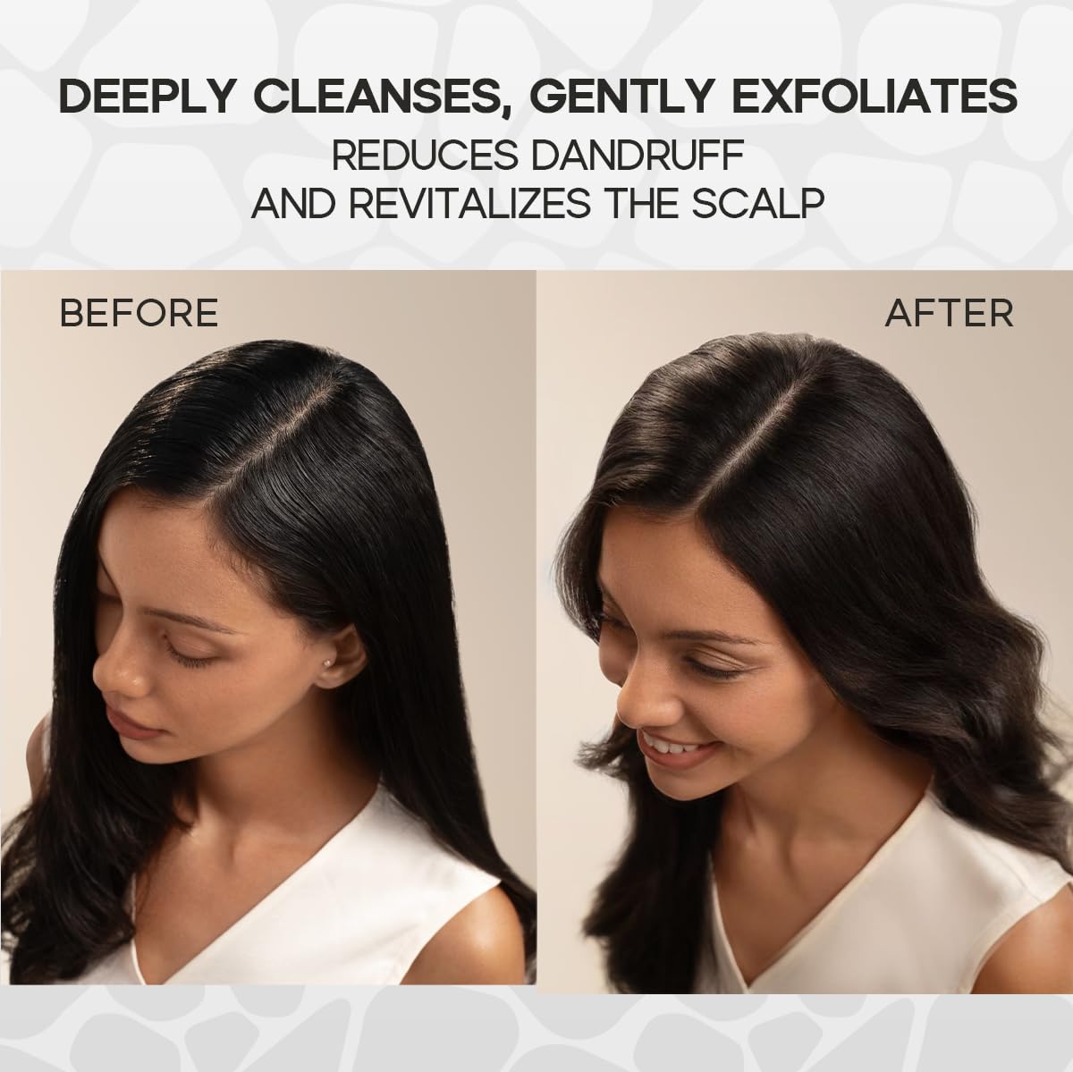 HALOVIDA Scrub massage doux : stimulation légère du cuir chevelu.