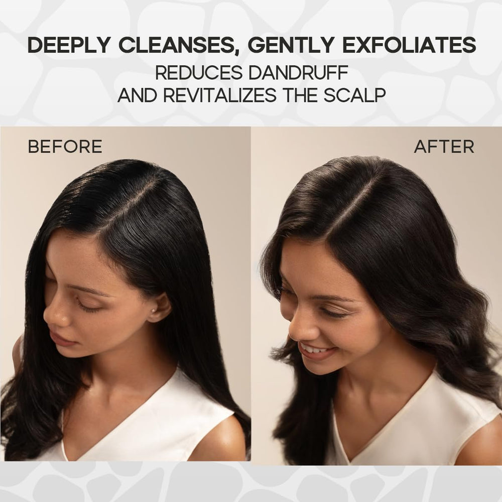 HALOVIDA Scrub massage doux : stimulation légère du cuir chevelu.
