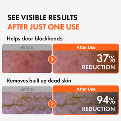 Hanskin AHA Pore Cleansing Oil, exfoliación suave para piel más suave