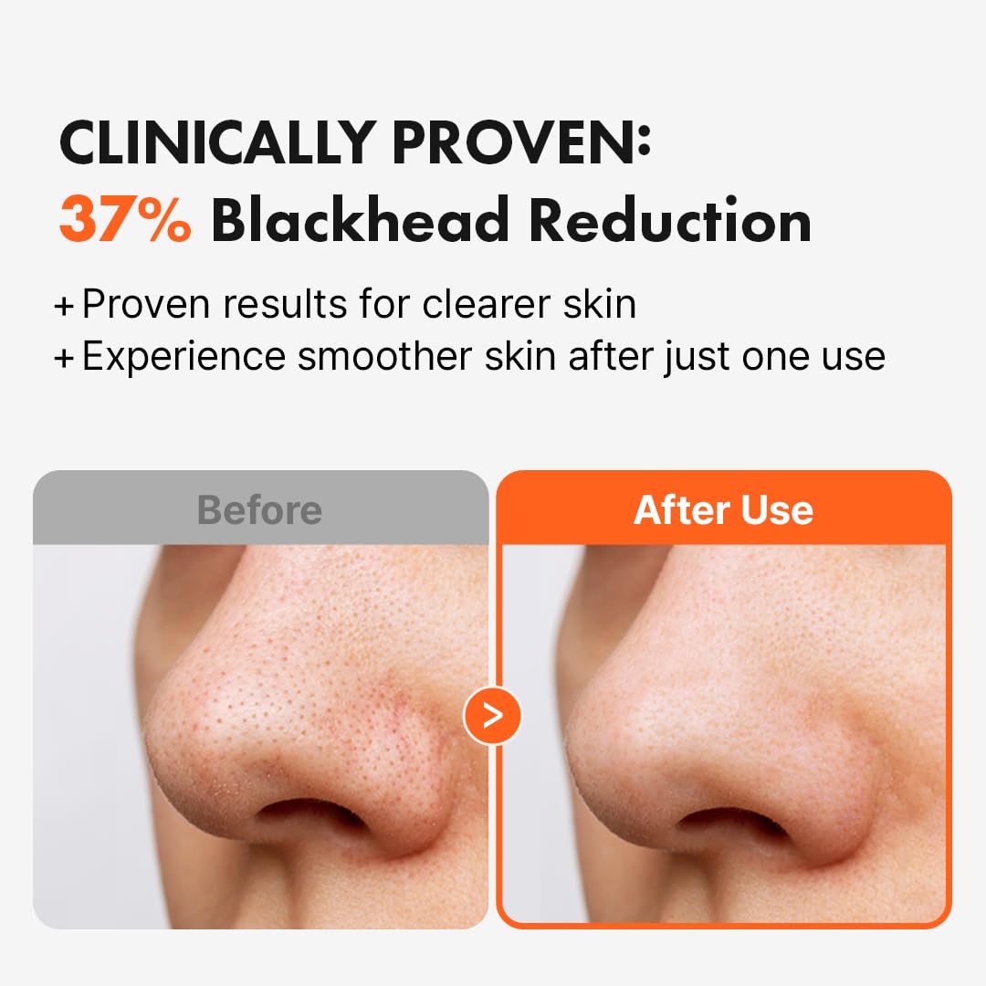 Hanskin AHA Pore Cleansing Oil, limpieza de poros profunda para piel limpia