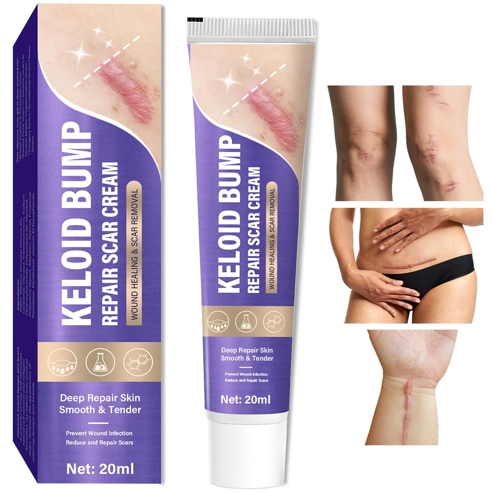 Hemir crema queloides para la cara, reducción visible del bulto con uso diario.