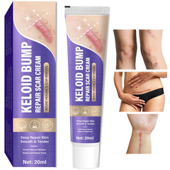 Hemir crema queloides para la cara, reducción visible del bulto con uso diario.