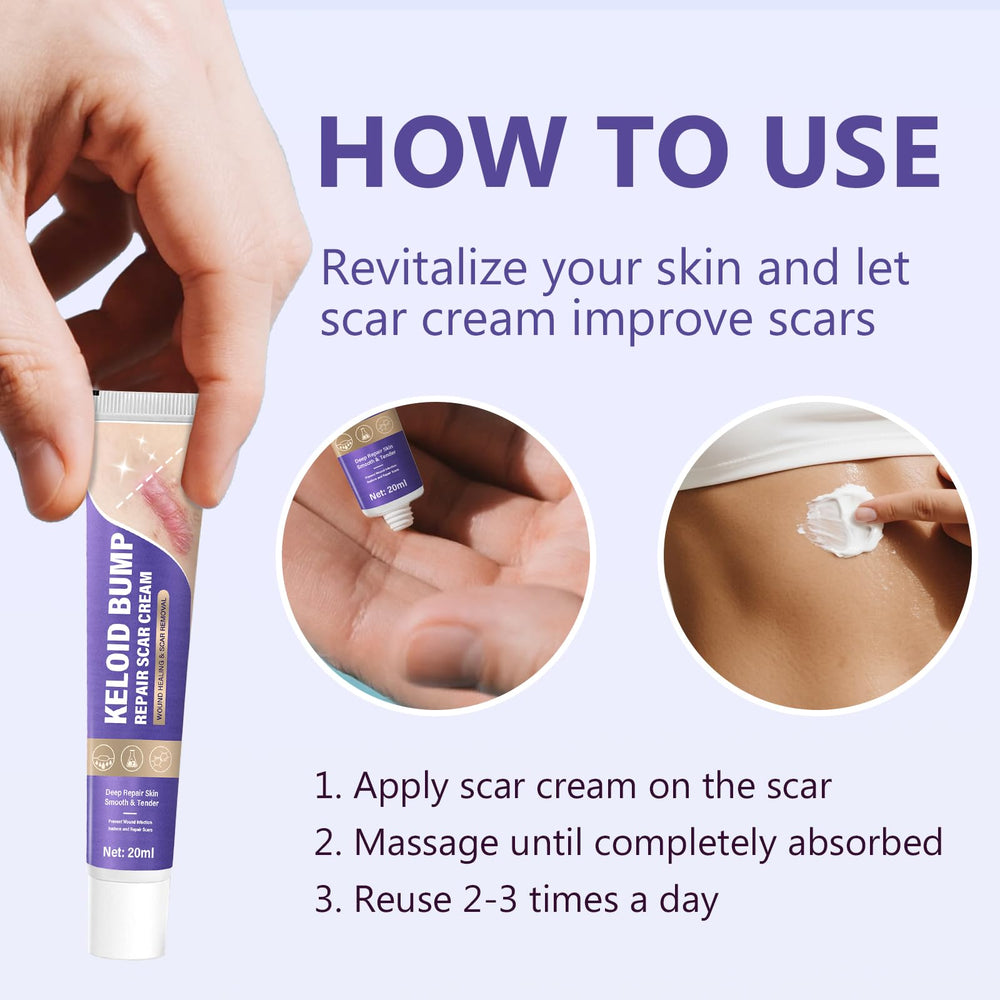 Hemir crema queloides, mejora la apariencia de cicatrices antiguas con uso continuo.