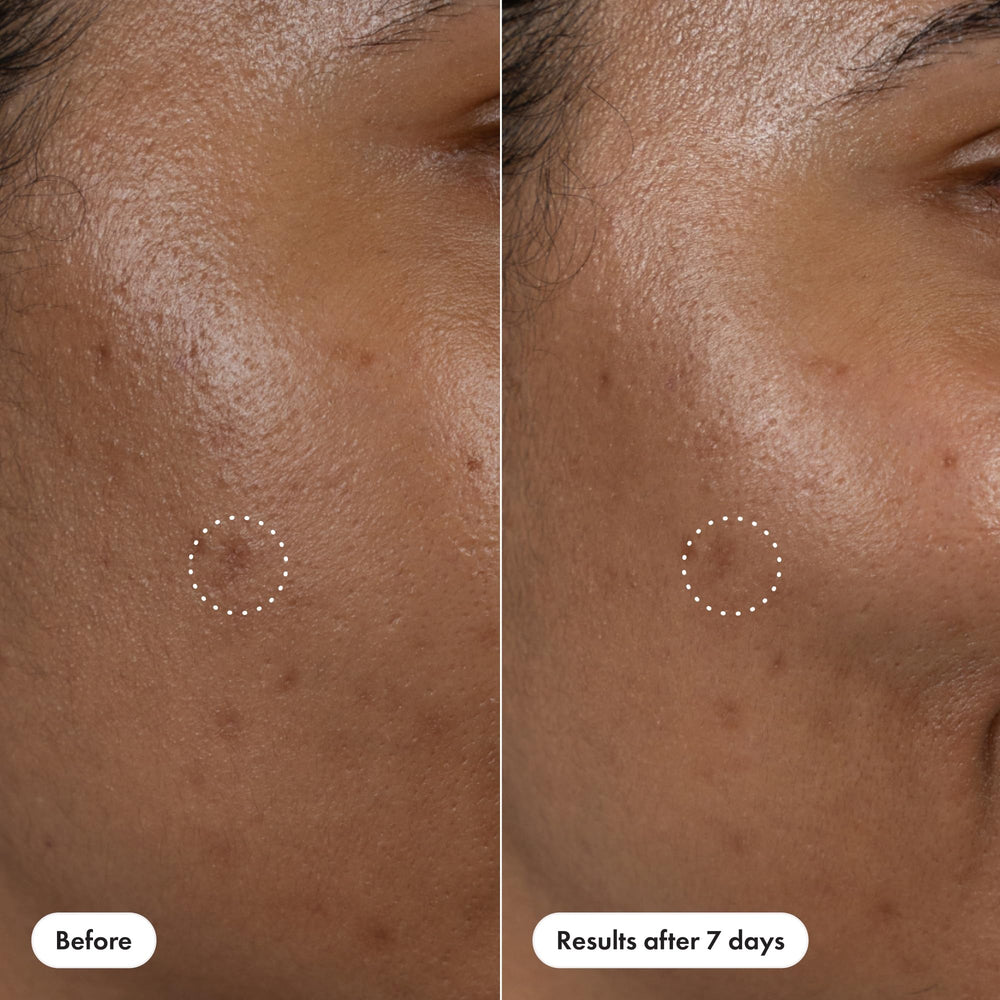 Tapa de seguridad de Dark Spot Correct para conservar el producto