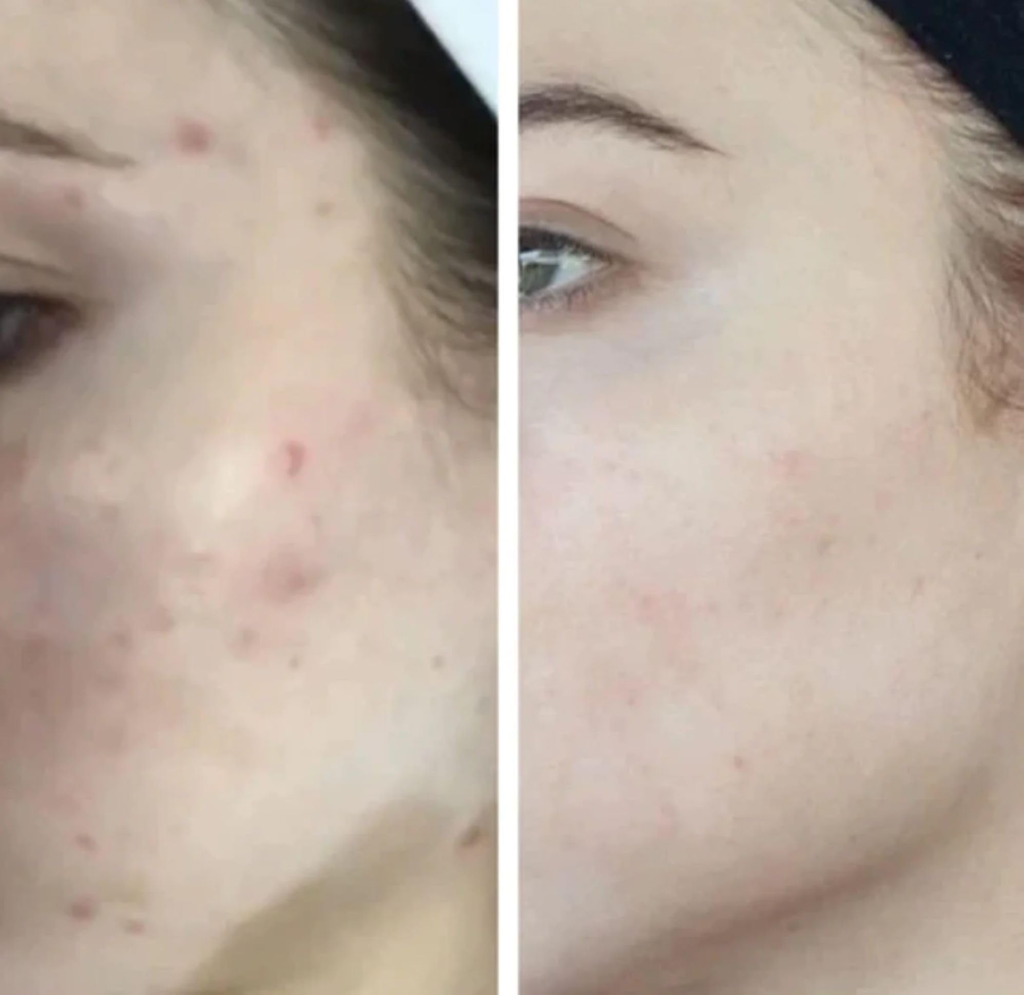 Effet hydratant du Glow Serum, peau plus souple et hydratée.