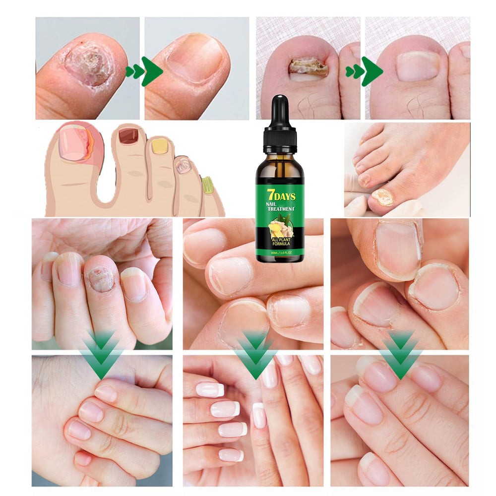IMOLL cutículas hidratadas con aceite de jengibre para suavidad