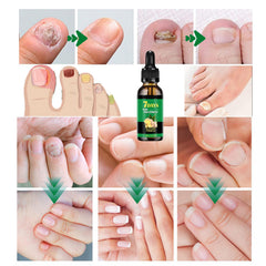 IMOLL cutículas hidratadas con aceite de jengibre para suavidad