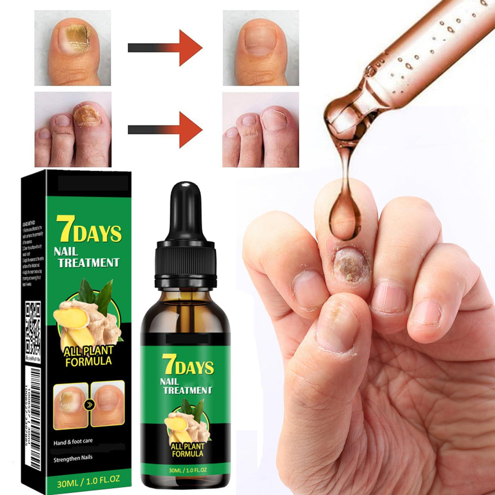 IMOLL suero para uñas con jengibre mantiene brillo natural