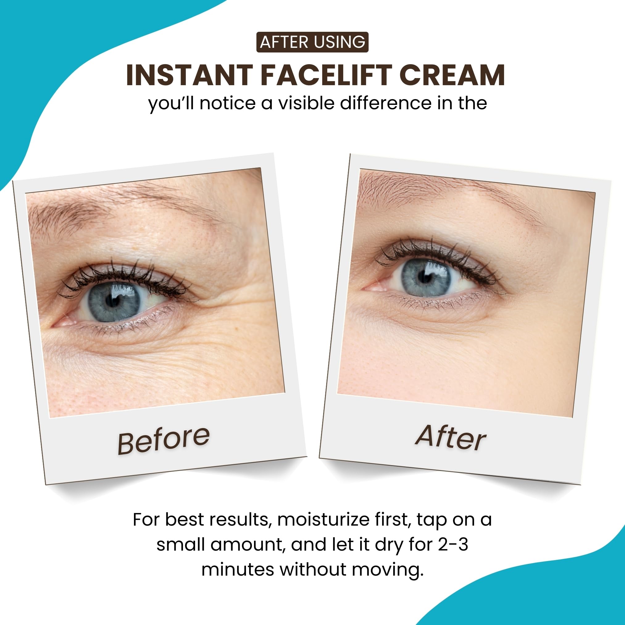 Instantly Ageless: levantamiento facial instantáneo para una apariencia más suave