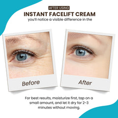 Instantly Ageless: levantamiento facial instantáneo para una apariencia más suave