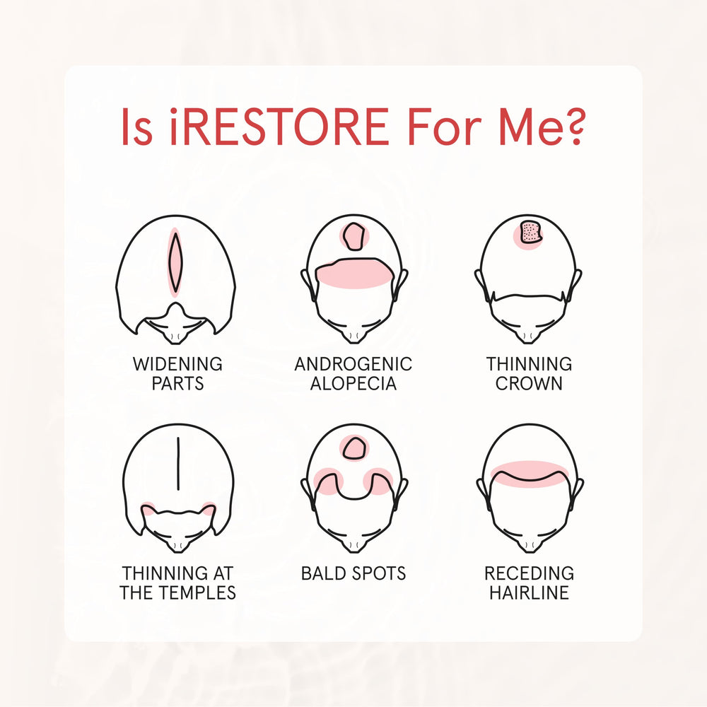 Aplicación manual con iRestore para reparto uniforme.
