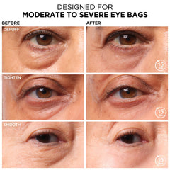 Aplicación de IT Cosmetics Bye Bye Bolsas Ojos para desinflamar suavemente.