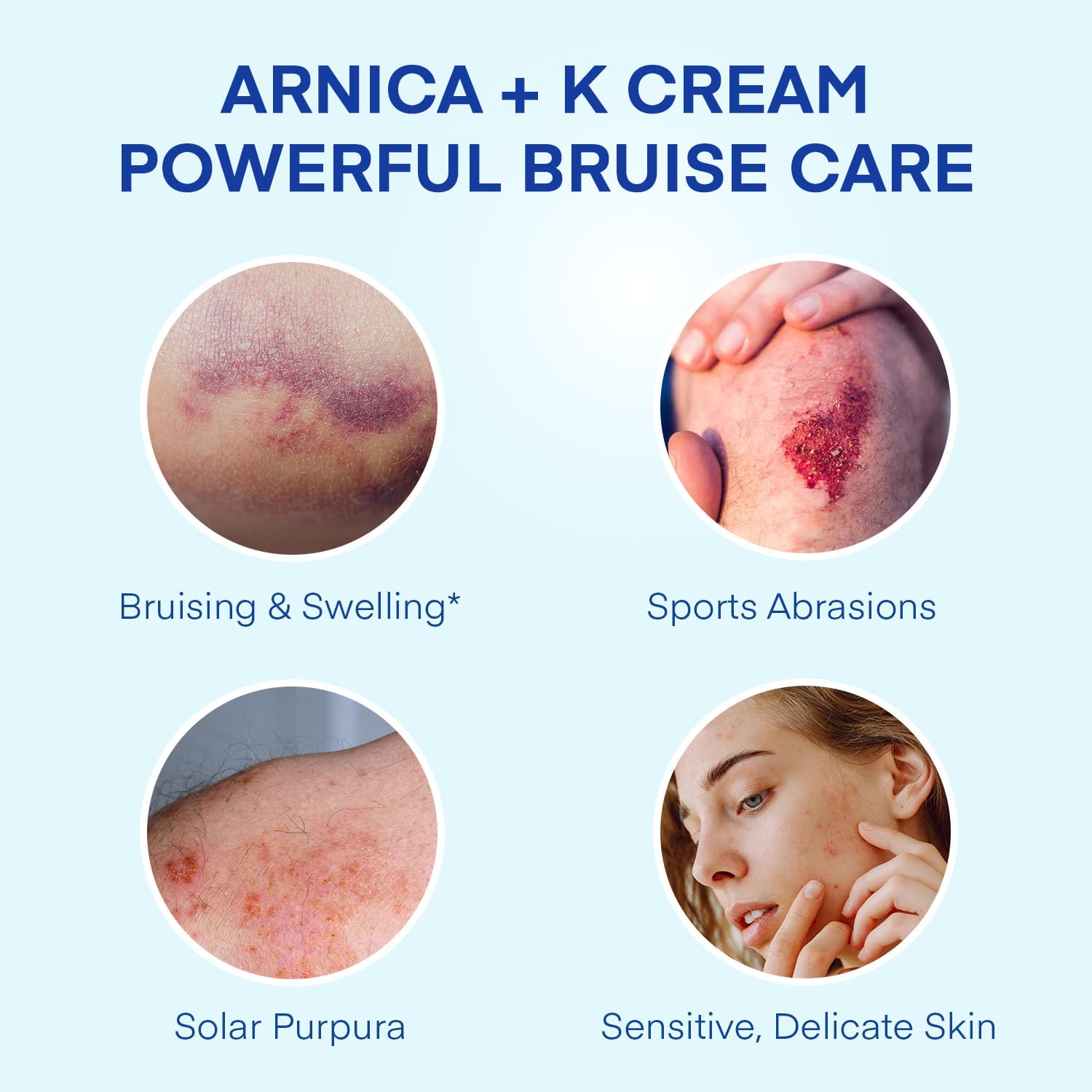 Jardient Arnica, aplicación en brazo, alivio suave tras golpes