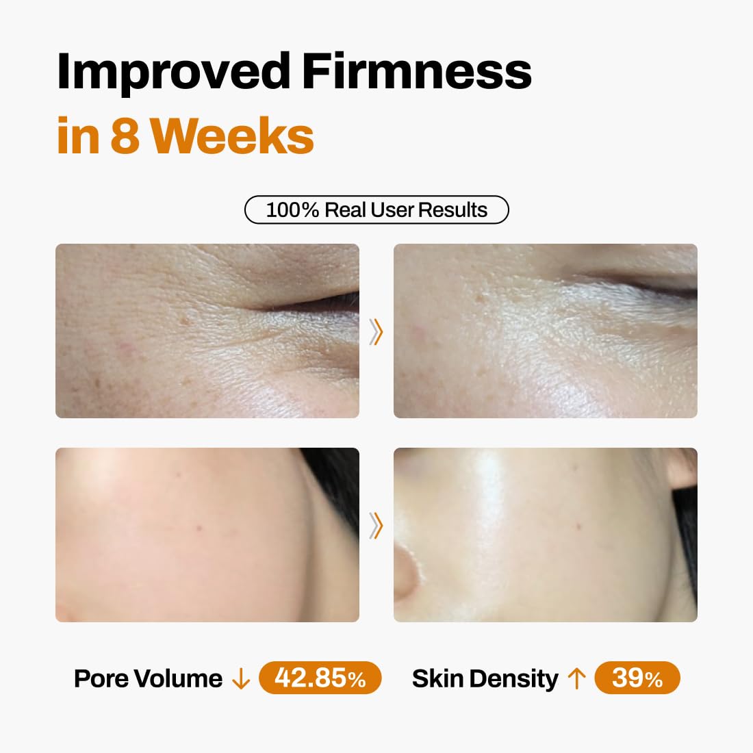 JeuDemeure DermiShuttle: resultados a 8 semanas con lifting visible.