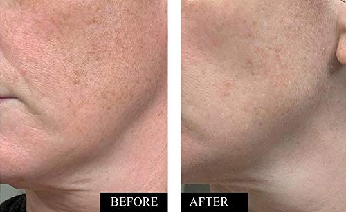 Kleem Organics Serum Vitamina C: textura ligera y de rápida absorción.