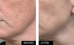 Kleem Organics Serum Vitamina C: textura ligera y de rápida absorción.