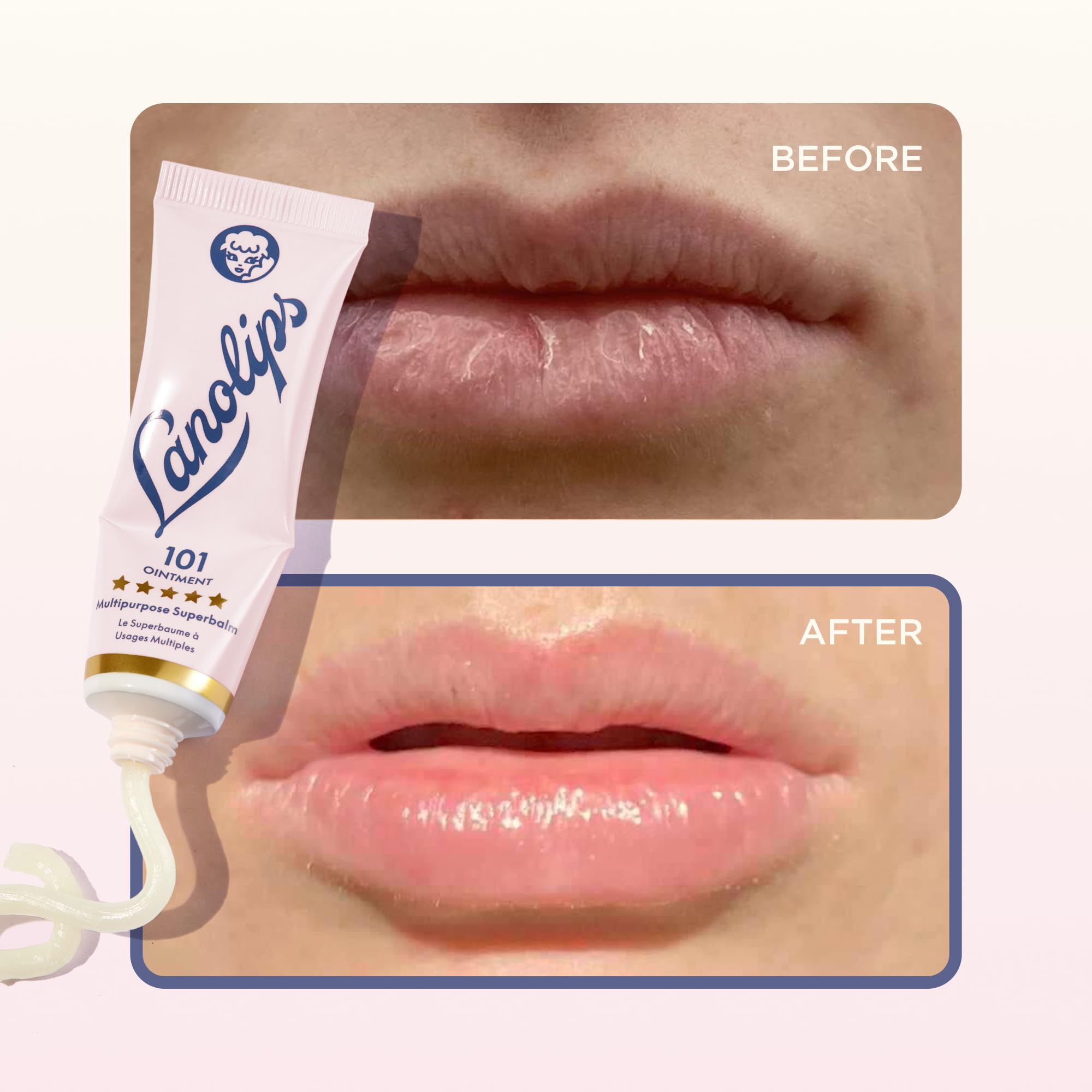 Lanolips 101 bálsamo para pezones durante lactancia