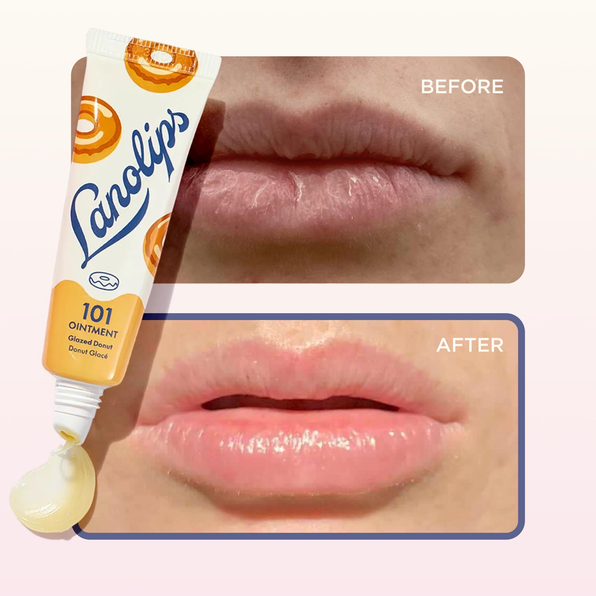 Aplicación suave en labios con Lanolips 101 Ungüento para hidratación.