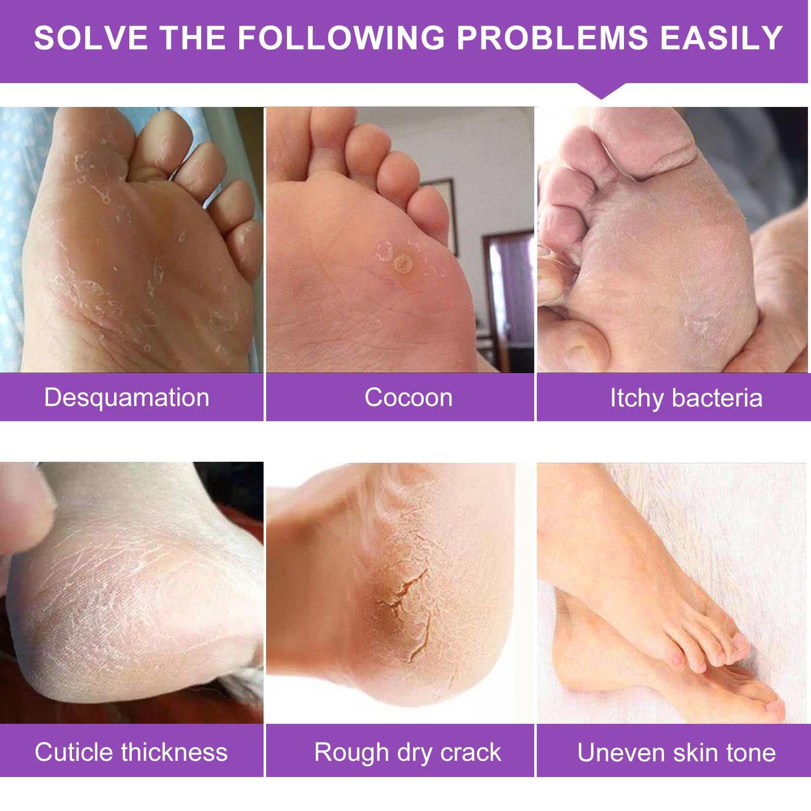Liefiet mask addressing dry heels with hydrating, non-irritating formula.