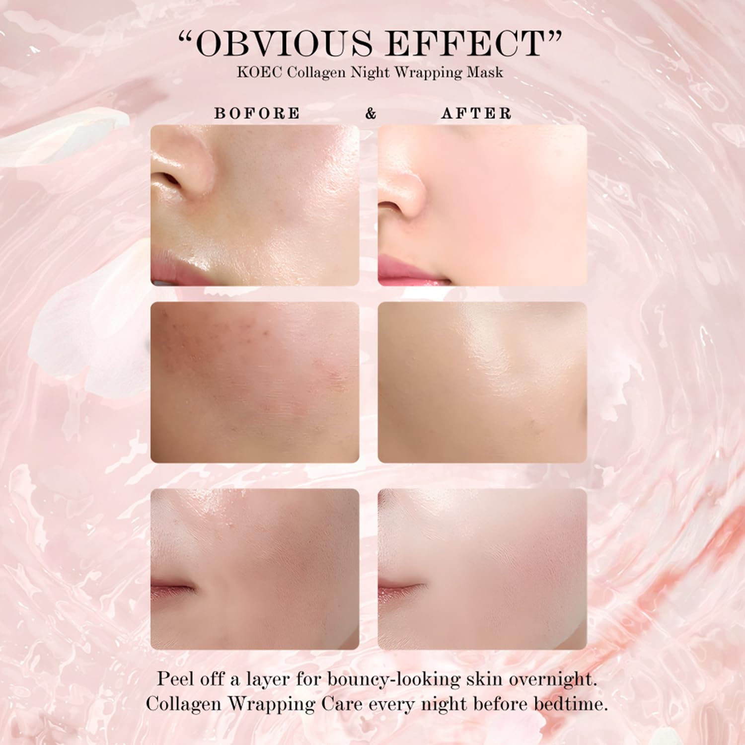LOYOTICE peel-off mask removal edge demonstrates clean, controlled peeling.