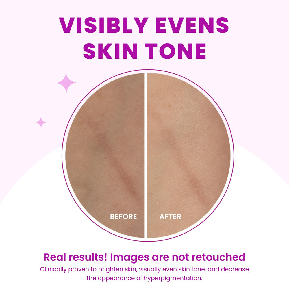 Lume multi-area usage idea for underarms and skin folds.