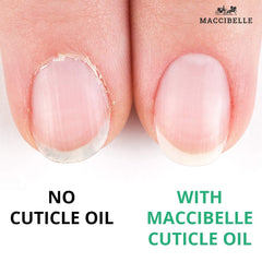 Maccibelle Vitamina-E Uñas Nutricion, cuidado suave de las uñas.
