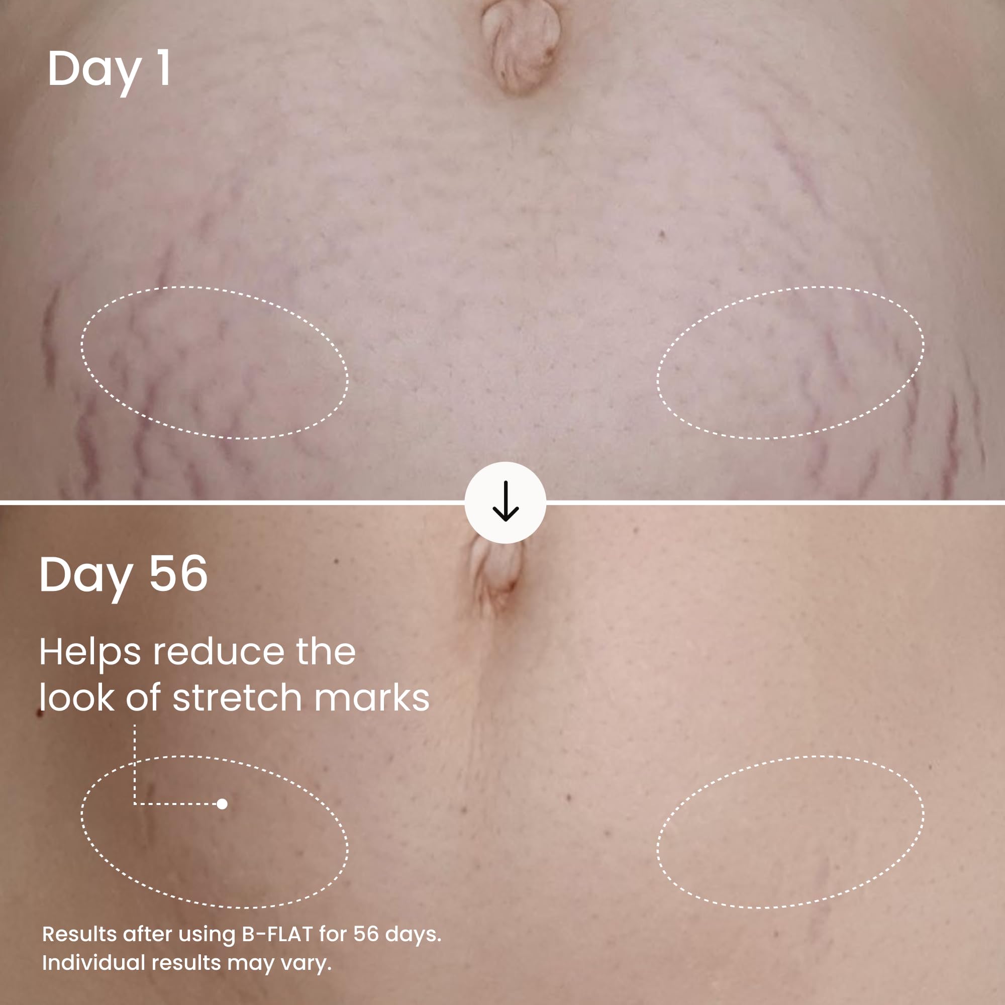 MAËLYS B-FLAT aplicación en giros para cuidado diario de la barriga.