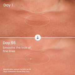 Texture du torse et des bras plus lisses grâce au sérum Maelys B-GLOSSY.