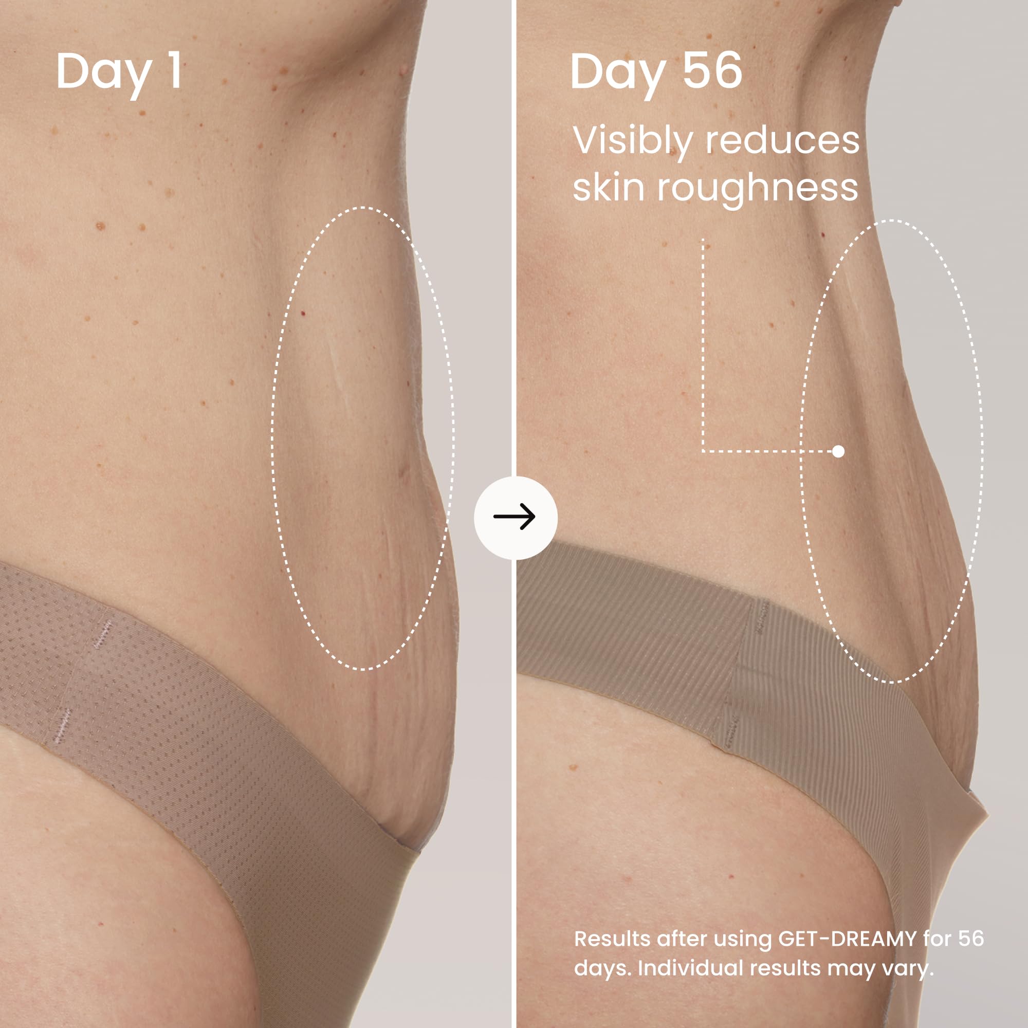 Geste de massage sur la cuisse avec Maëlys Get-Dreamy durant l’application.
