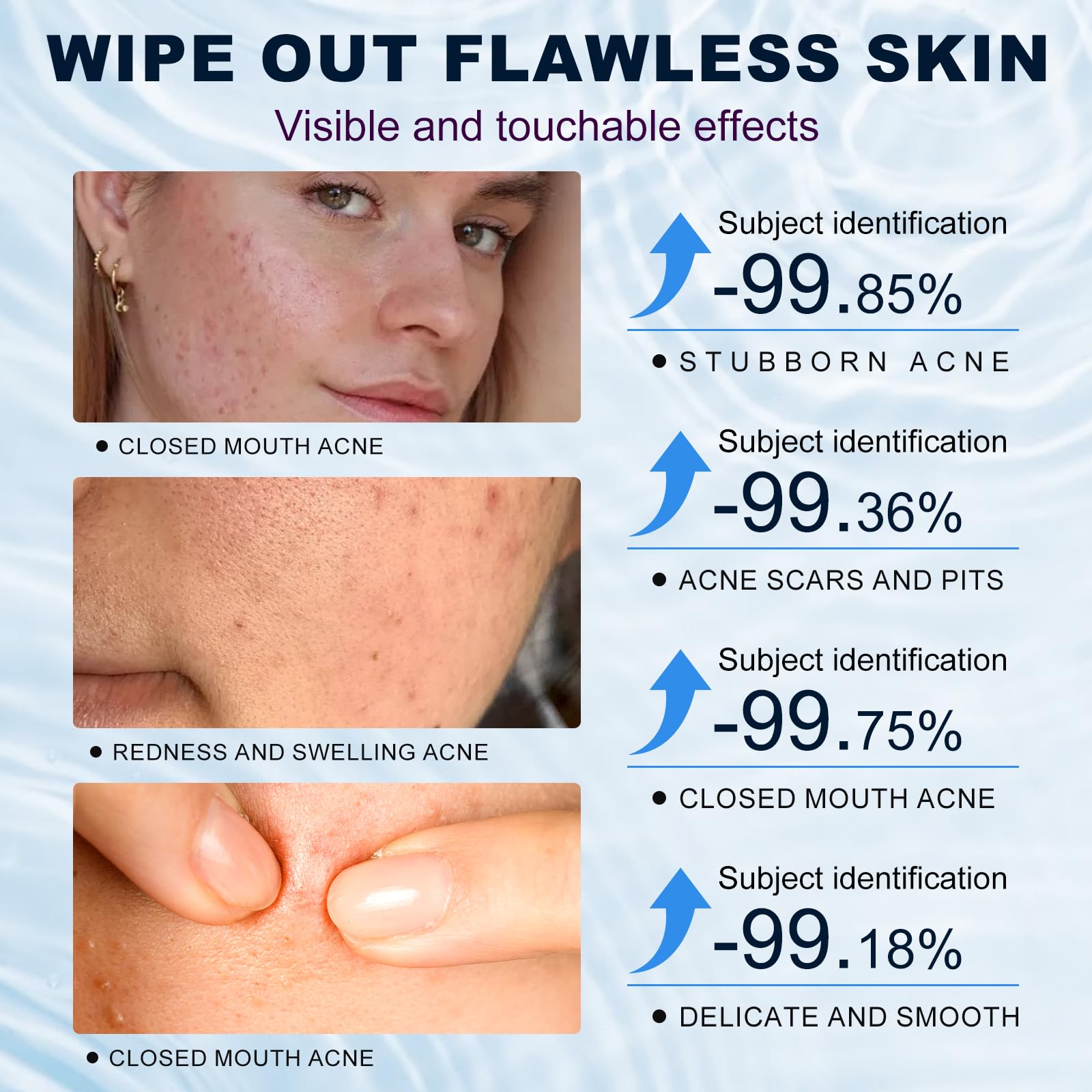 marianp crema ácido azelaico 10% textura suave cuida la barrera cutánea