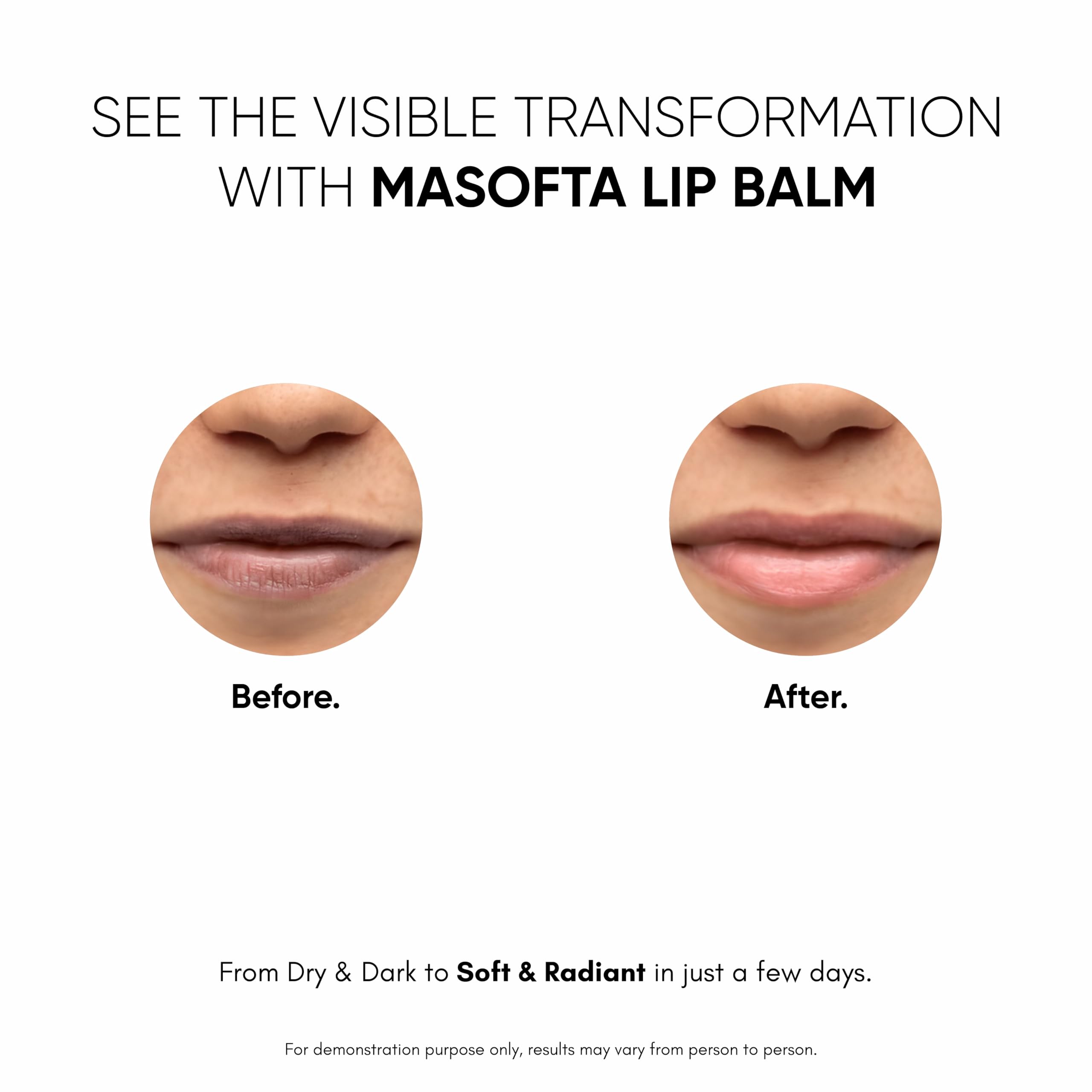 Masofta Balsamo Labios, protección SPF 30 para labios expuestos.