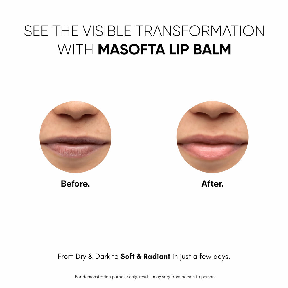 Masofta Balsamo Labios, protección SPF 30 para labios expuestos.