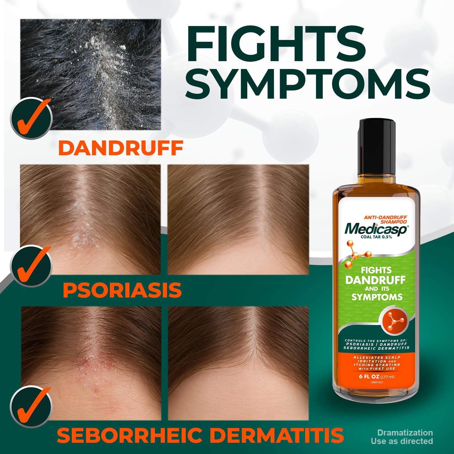 Medicasp Coal Tar Shampoo application scene shows scalp massage for soothing relief.
