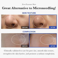 Medicube Exosome Shot Zero – application sur les pores avec précision et douceur.
