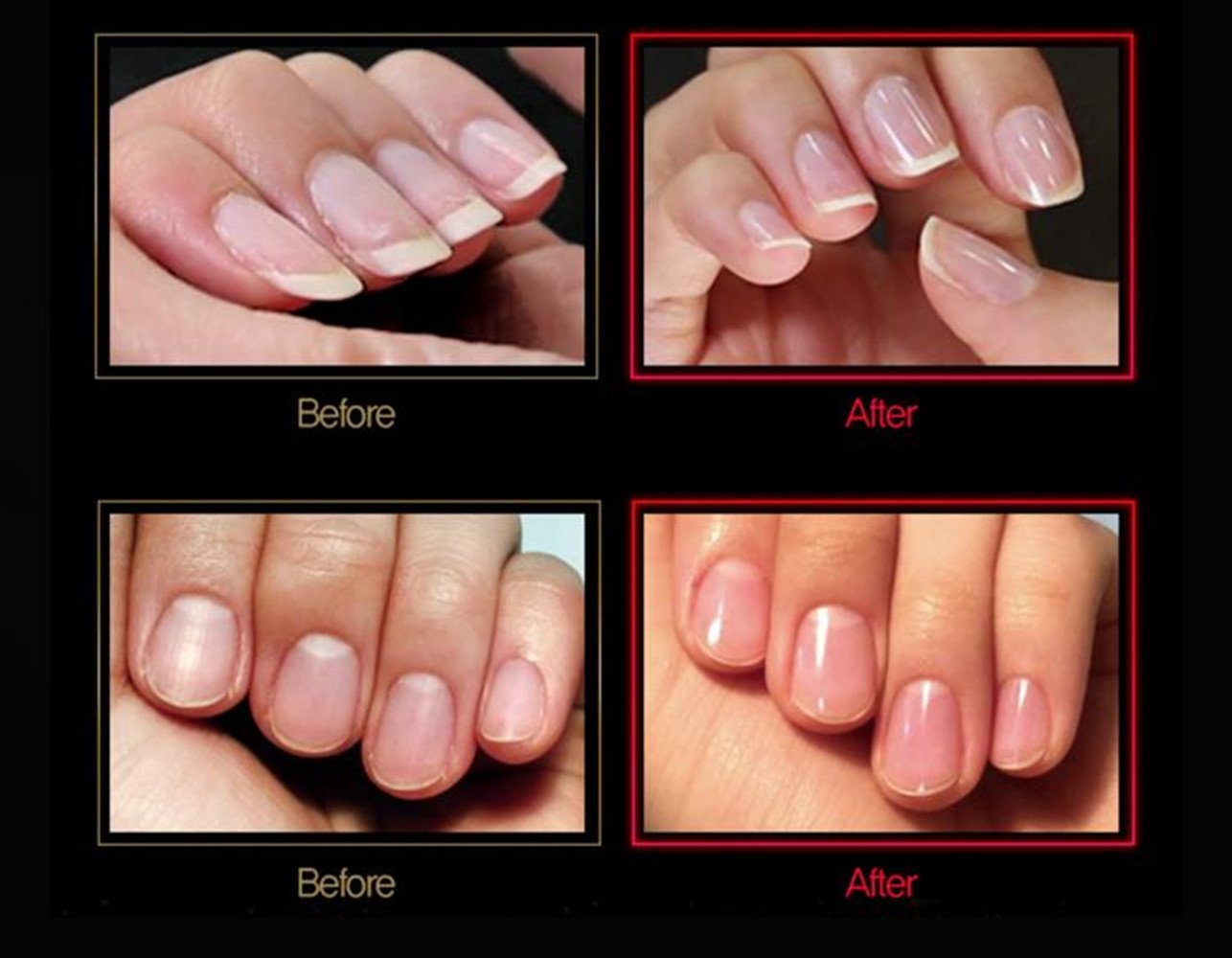 MiDenso uso seguro para uñas naturales y acrílicas, manicura suave.