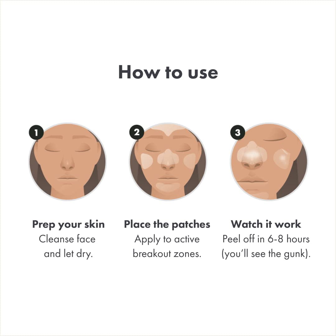 Mighty Patch hydrocolloïde médical utilisé sur le visage.