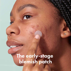 Mighty Patch Micropoint Grande: aplicación en la piel para imperfecciones tempranas