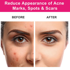 MMPANG Aceite rosa mosqueta sin refinar para absorción suave