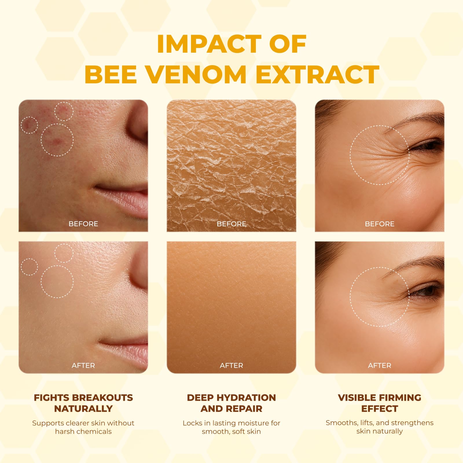 MONIER crema veneno de abeja, ingredientes botánicos, nutrición profunda para la piel.